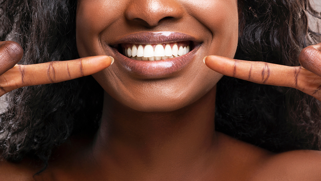 Teeth Whitening Tunbridge Wells