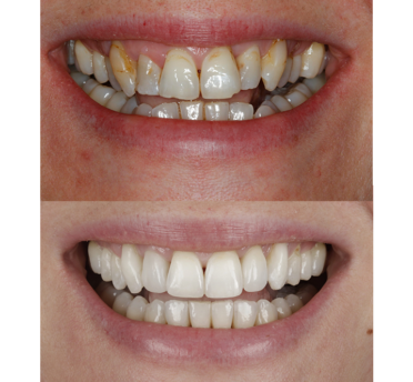 Smile Gallery