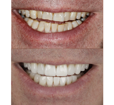 Smile Gallery