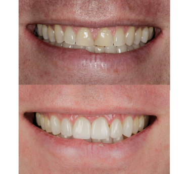 Smile Gallery
