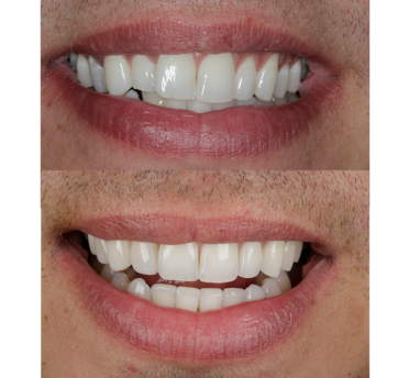Smile Gallery