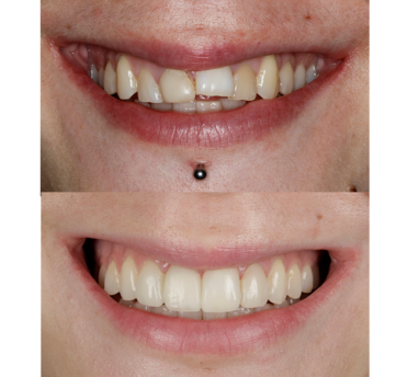 Smile Gallery