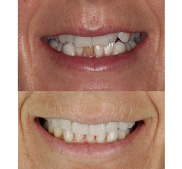 Smile Gallery