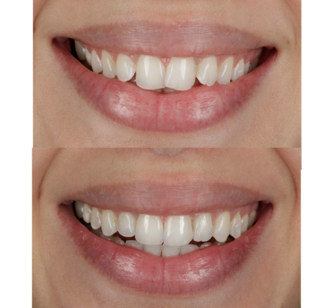 Smile Gallery
