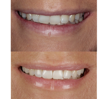Smile Gallery