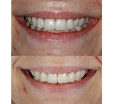 Smile Gallery