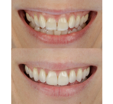 Smile Gallery