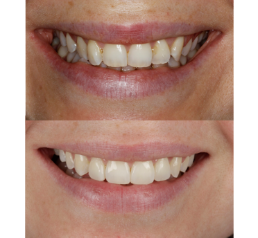 Smile Gallery