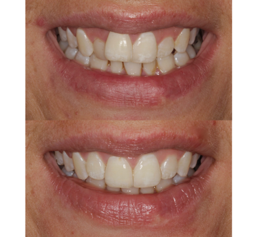 Smile Gallery