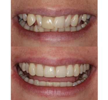 Smile Gallery