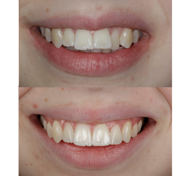 Smile Gallery