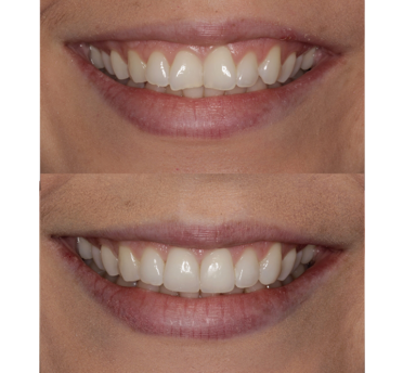 Smile Gallery