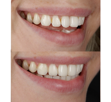 Smile Gallery