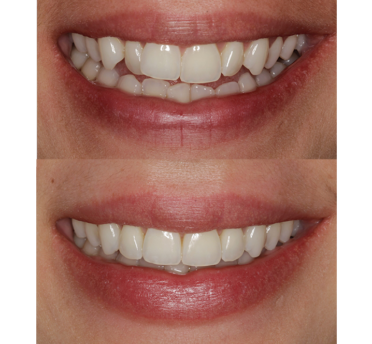 Smile Gallery