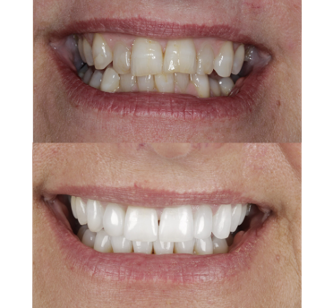 Smile Gallery