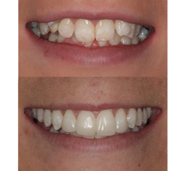 Smile Gallery