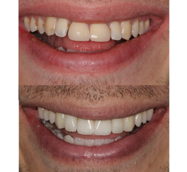 Smile Gallery
