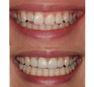 Smile Gallery
