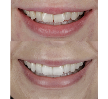 Smile Gallery