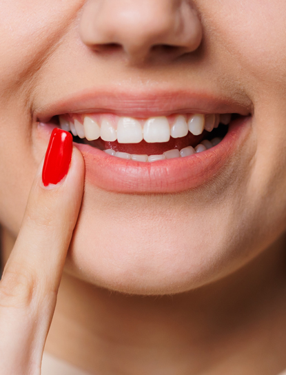 Dental Therapy