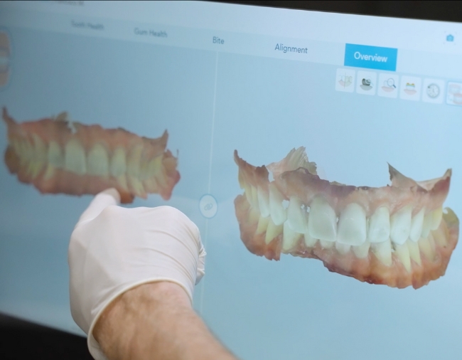 Digital Smile Design